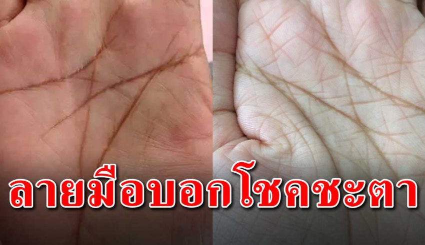 เส้นกากบาทบนฝ่ามือคุณ สามารถบ่งบอกดวงชะตาคุณได้